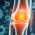 Hyalofast – nowoczesna rehabilitacja i regeneracja chrząstki